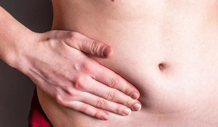 abdomenul unei persoane cu durere inghinala