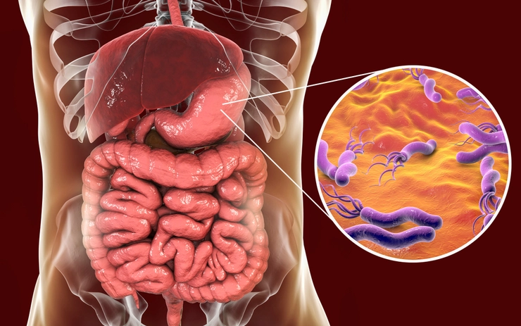 grafica helicobacter pylori