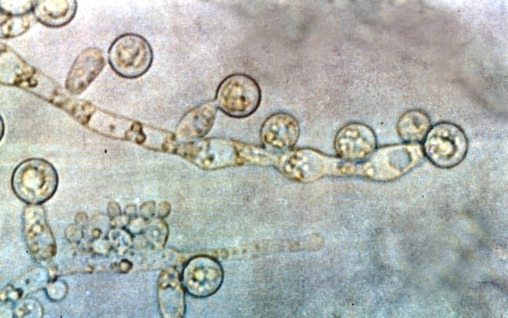 candida albicanis la microscop
