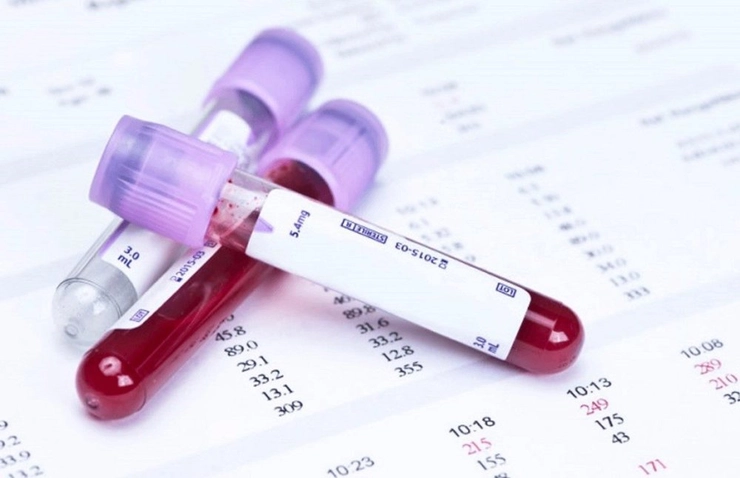 mai multe eprubete cu analiza de sange pe un dosar cu rezultatele analizelor