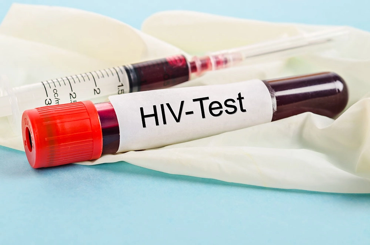 o imagine cu un test HIV