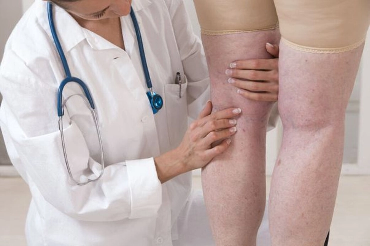 medic care se uită la picioarele unei paciente