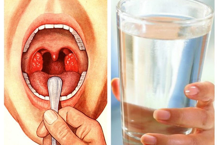 colaj grafic, gura deschisa a unei persoane in timpul unui control si un pahar de apa cu sare intr-o mana