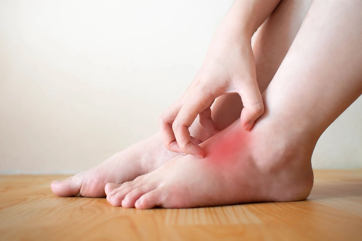 grafica persoana care se tine de picior din cauza durerii