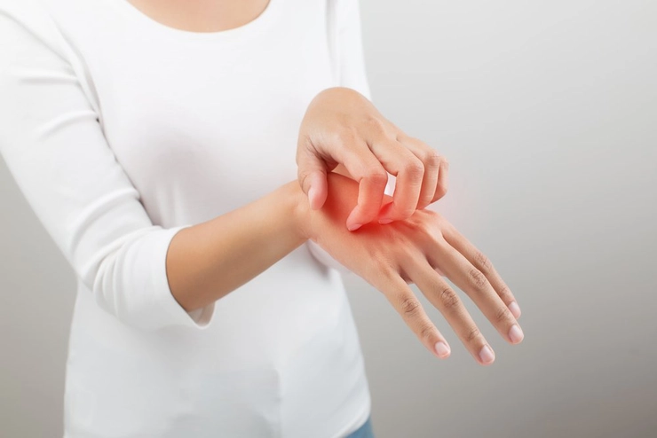 grafica femeie care sufera de mancarimi pe mana din cauza nervilor