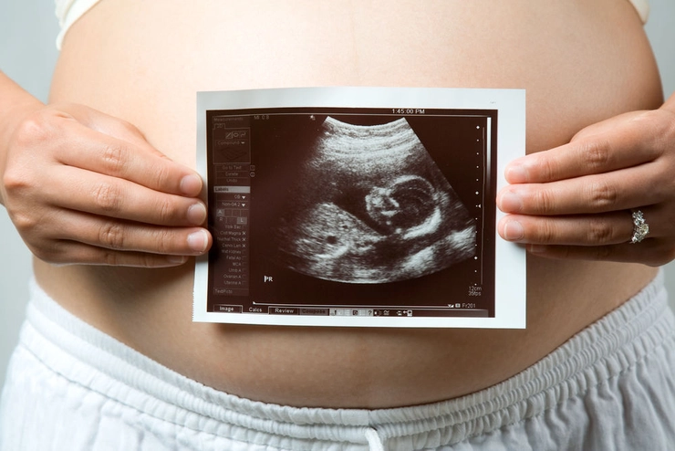 o femeie însărcinată cu ecografia unui bebeluș