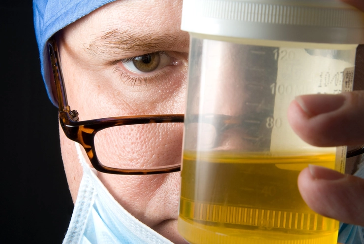 medic care tine in mana un recipient cu urina
