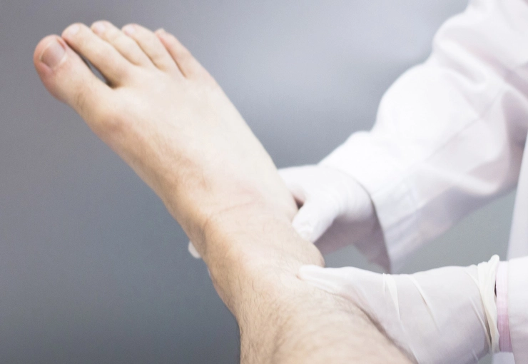 medic care examineaza piciorul unei persoane