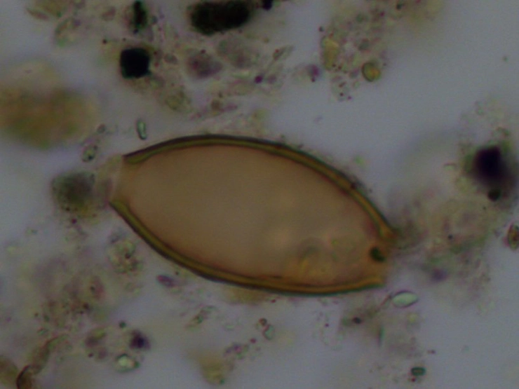 ou de vierme intestinal la nivelul microscopului 