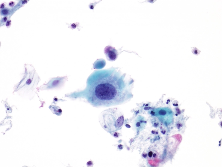 celule epiteliale scuamoase la nivel de microscop