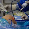 Artroscopia de genunchi o metodă avansată de diagnostic și tratament pentru afecțiunile articulare 8211 VIDEO
