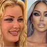 Cum arăta Bianca Drăgușanu tânără Internauții spun că era mult mai frumoasă înainte de zecile de operații estetice