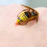 Înțepătura de viespe este periculoasă Ce spun medicii