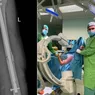 Operație în premieră la Oradea în cazul unui adolescent rănit grav într-un accident rutier